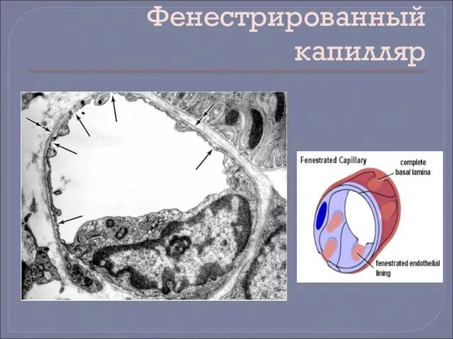 Фенестрированный капилляр