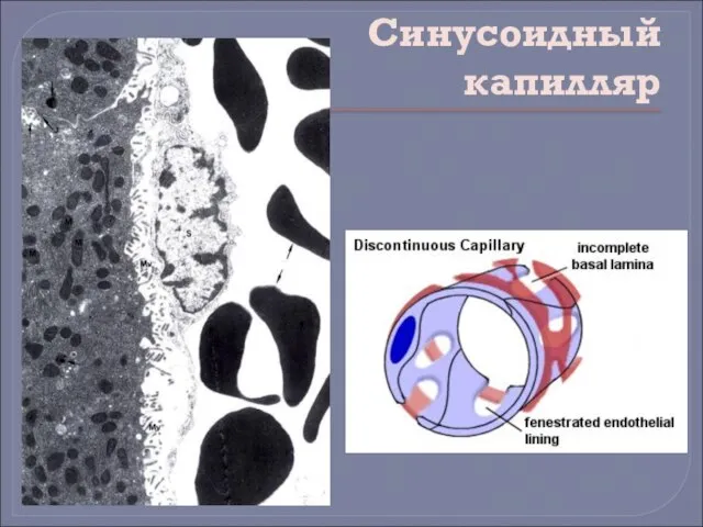 Синусоидный капилляр