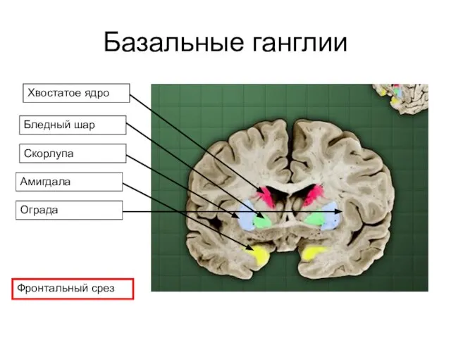 Базальные ганглии Хвостатое ядро Бледный шар Скорлупа Амигдала Ограда Фронтальный срез