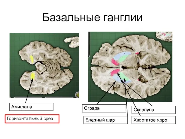 Базальные ганглии Горизонтальный срез Хвостатое ядро Бледный шар Скорлупа Амигдала Ограда Бледный