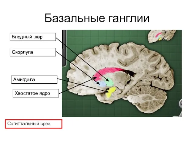 Базальные ганглии Сагиттальный срез Амигдала Хвостатое ядро Скорлупа Бледный шар Скорлупа Бледный