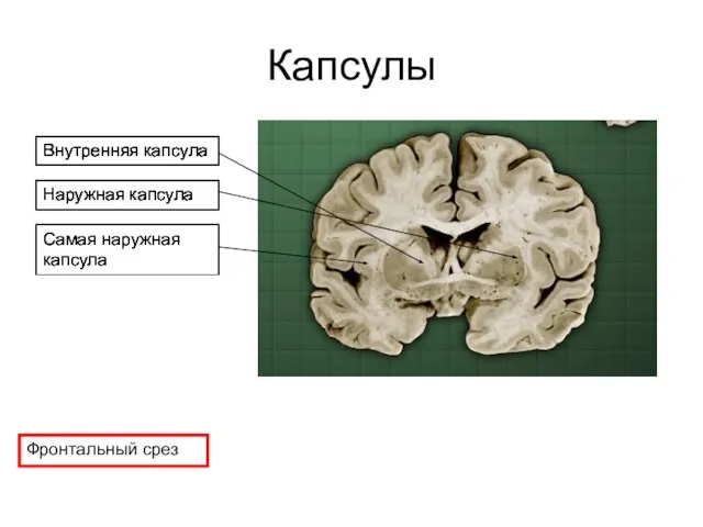 Капсулы Внутренняя капсула Наружная капсула Самая наружная капсула Фронтальный срез Внутренняя капсула