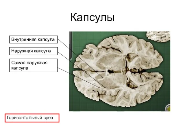 Капсулы Горизонтальный срез Самая наружная капсула Внутренняя капсула Наружная капсула Внутренняя капсула