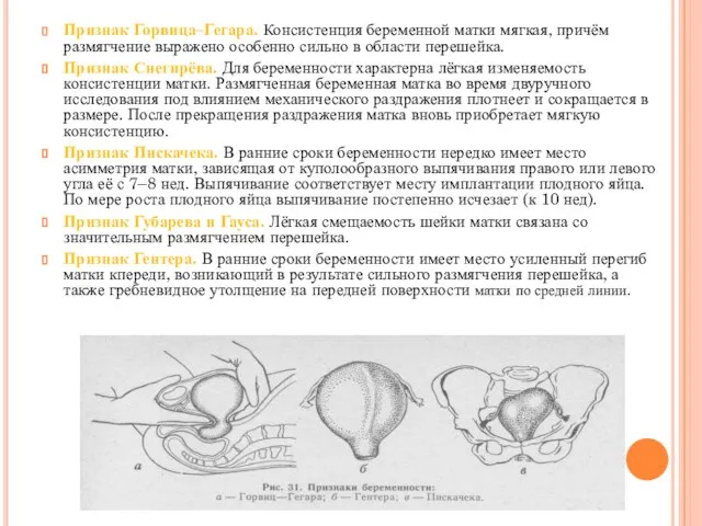 Признак Горвица–Гегара. Консистенция беременной матки мягкая, причём размягчение выражено особенно сильно в