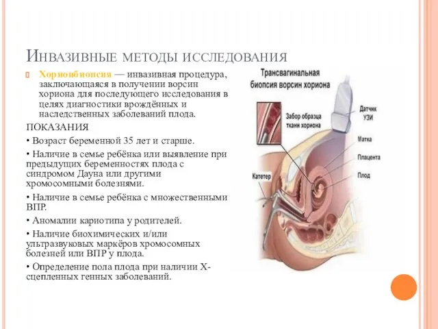 Инвазивные методы исследования Хорионбиопсия — инвазивная процедура, заключающаяся в получении ворсин хориона