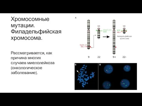 Хромосомные мутации. Филадельфийская хромосома. Рассматривается, как причина многих случаев миелолейкоза (онкологическое заболевание).