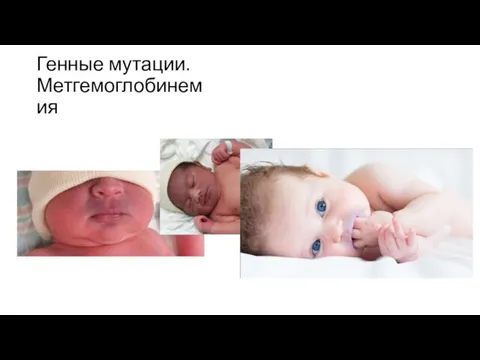 Генные мутации. Метгемоглобинемия