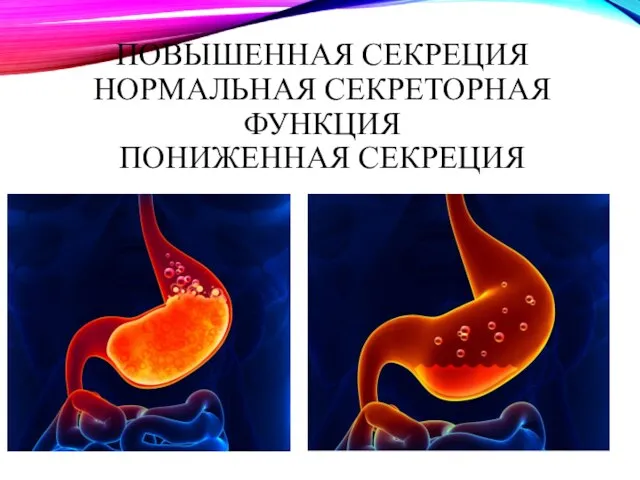 ПОВЫШЕННАЯ СЕКРЕЦИЯ НОРМАЛЬНАЯ СЕКРЕТОРНАЯ ФУНКЦИЯ ПОНИЖЕННАЯ СЕКРЕЦИЯ