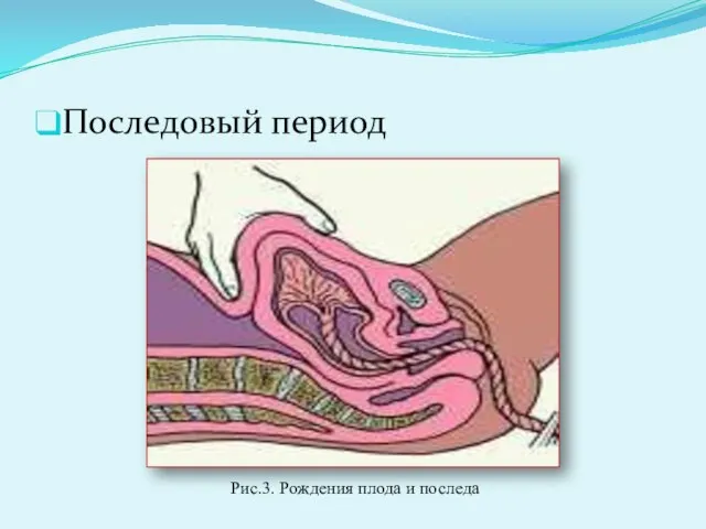 Последовый период Рис.3. Рождения плода и последа