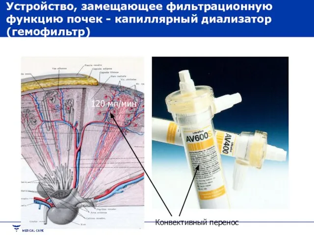 Конвективный перенос 120 мл/мин Устройство, замещающее фильтрационную функцию почек - капиллярный диализатор (гемофильтр)