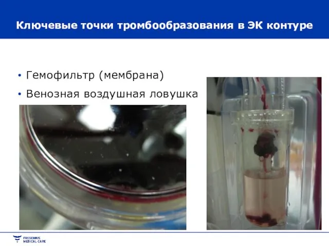 Ключевые точки тромбообразования в ЭК контуре Гемофильтр (мембрана) Венозная воздушная ловушка