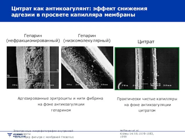 Цитрат как антикоагулянт: эффект снижения адгезии в просвете капилляра мембраны Hofbauer et