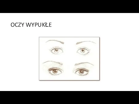 OCZY WYPUKŁE