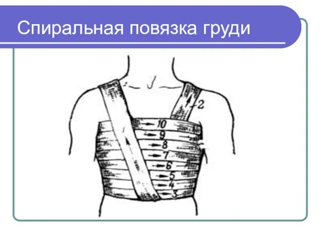 Спиральная повязка груди