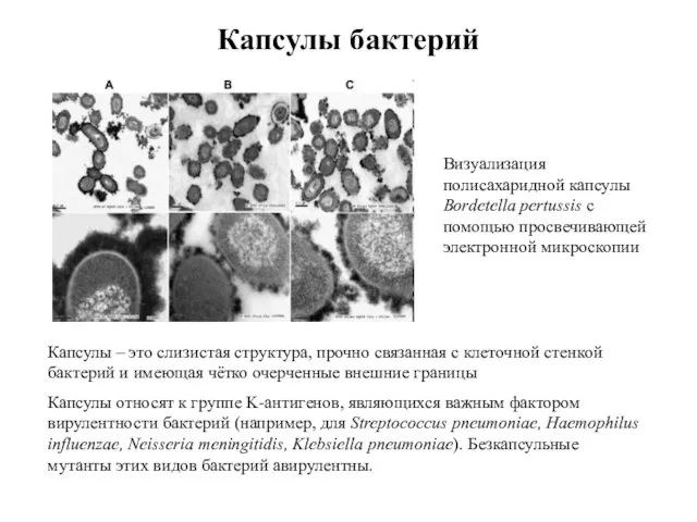 Капсулы бактерий Визуализация полисахаридной капсулы Bordetella pertussis с помощью просвечивающей электронной микроскопии