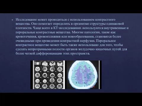 Исследование может проводиться с использованием контрастного вещества. Оно помогает определить в организме