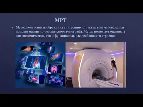 МРТ Метод получения изображения внутренних структур тела человека при помощи магнитно-резонансного томографа.