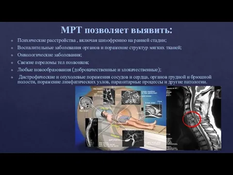 МРТ позволяет выявить: Психические расстройства , включая шизофрению на ранней стадии; Воспалительные