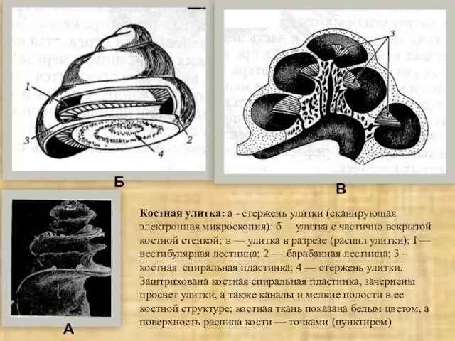 Костная улитка: а - стержень улитки (сканирующая электронная микроскопия): б— улитка с