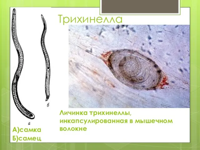 Трихинелла А)самка Б)самец Личинка трихинеллы, инкапсулированная в мышечном волокне