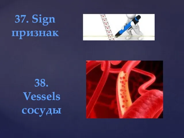 37. Sign признак 38. Vessels сосуды