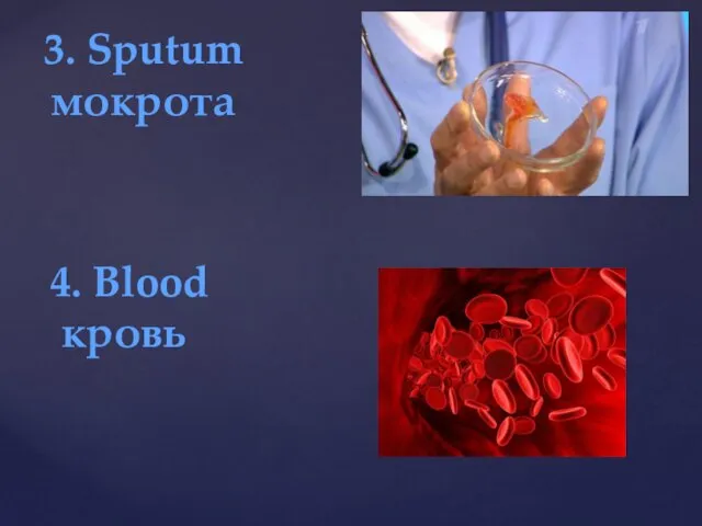 3. Sputum мокрота 4. Blood кровь