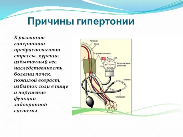 Причины гипертонии К развитию гипертонии предрасполагают стрессы, курение, избыточный вес, наследственность, болезни