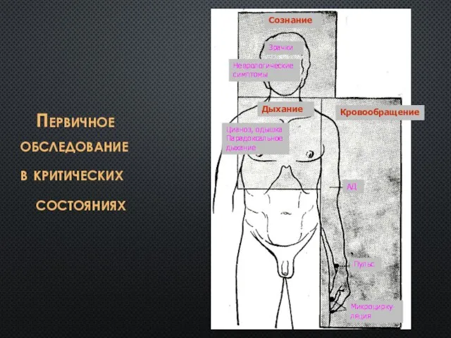 Первичное обследование в критических состояниях Сознание Зрачки Неврологические симптомы Кровообращение Дыхание Цианоз,