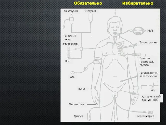 Обязательно Избирательно Трансфузия Инфузия Венозный доступ Забор крови ЦВД АД Пульс Диурез
