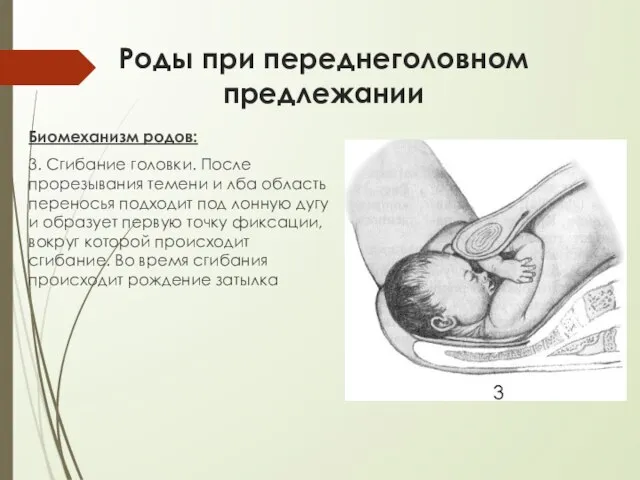 Роды при переднеголовном предлежании Биомеханизм родов: 3. Сгибание головки. После прорезывания темени