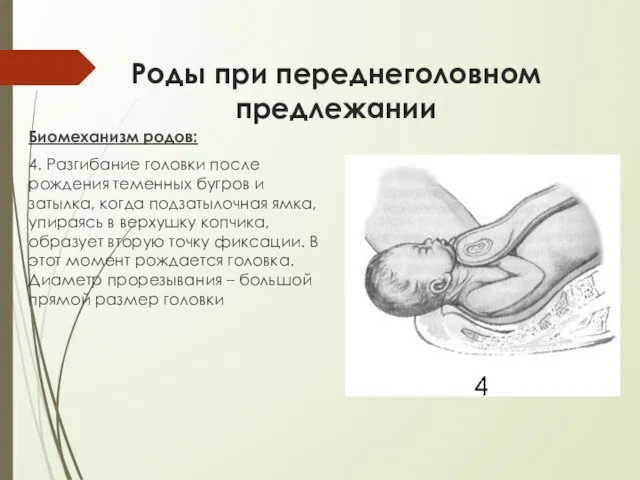 Роды при переднеголовном предлежании Биомеханизм родов: 4. Разгибание головки после рождения теменных