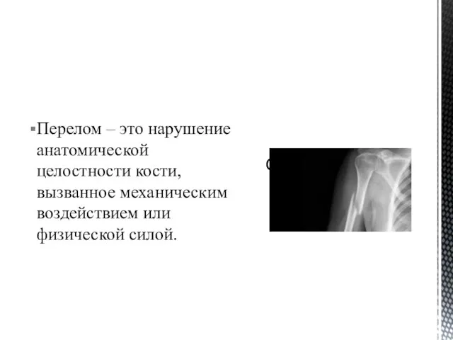 Перелом – это нарушение анатомической целостности кости, вызванное механическим воздействием или физической силой. Определение