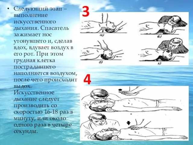 Следующий этап – выполнение искусственного дыхания. Спасатель зажимает нос утонувшего и, сделав