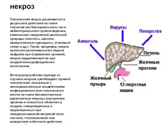Токсический некроз Токсический некроз развивается в результате действия на ткани токсинов как