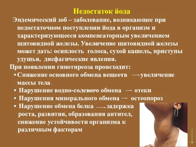 Недостаток йода Эндемический зоб – заболевание, возникающее при недостаточном поступлении йода в