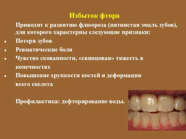 Избыток фтора Приводит к развитию флюороза (пятнистая эмаль зубов), для которого характерны