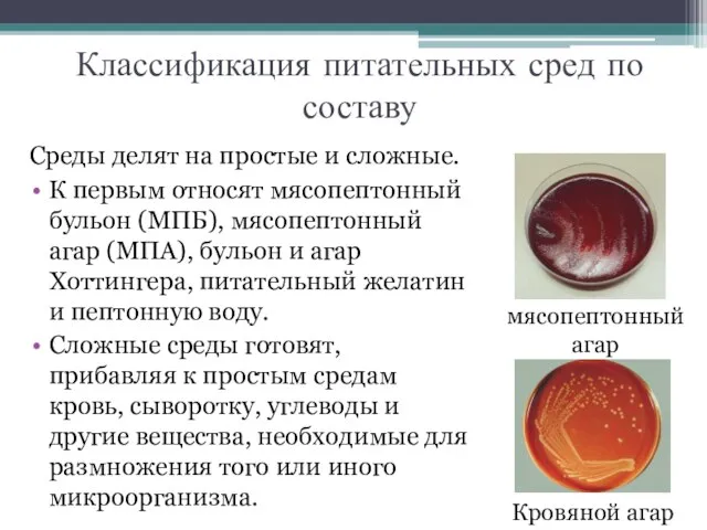 Классификация питательных сред по составу Среды делят на простые и сложные. К