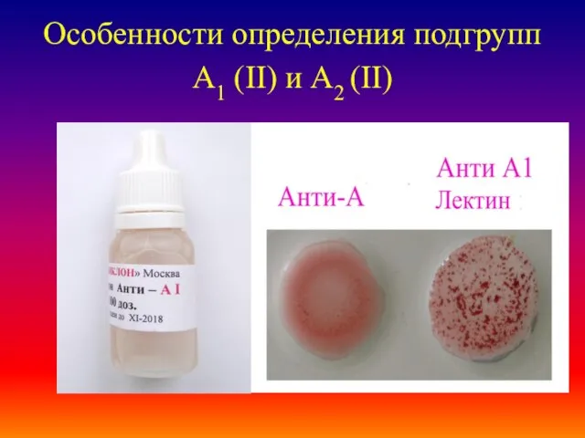 Особенности определения подгрупп А1 (II) и А2 (II)