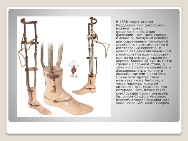 В 1696 году Питером Вердайном был разработан ножной протез, предназначенный для фиксации