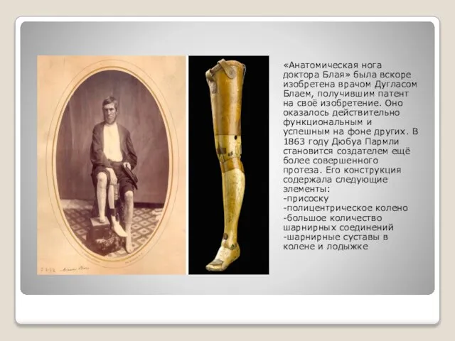 «Анатомическая нога доктора Блая» была вскоре изобретена врачом Дугласом Блаем, получившим патент