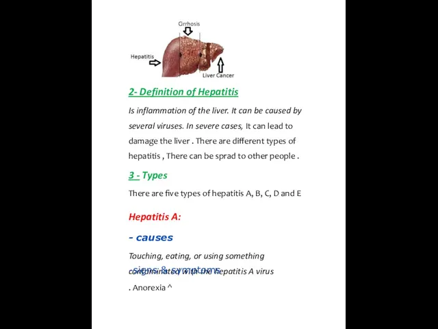 Cirrhosis 2- Definition of Hepatitis Is inflammation of the liver. It can