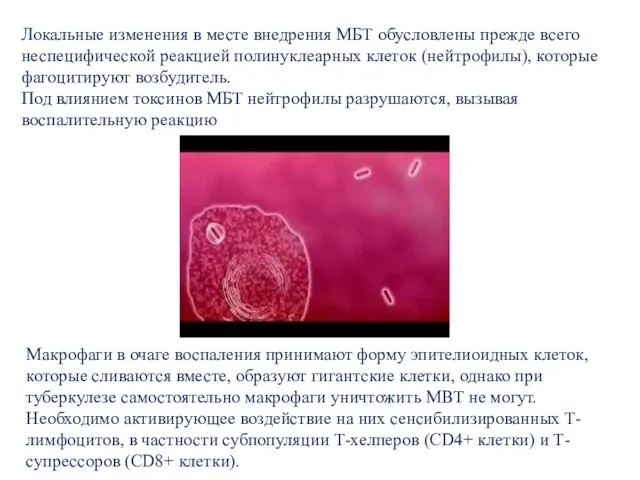 Локальные изменения в месте внедрения МБТ обусловлены прежде всего неспецифической реакцией полинуклеарных