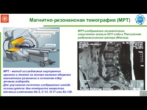 Магнитно-резонансная томография (МРТ) МРТ - метод исследования внутренних органов и тканей на