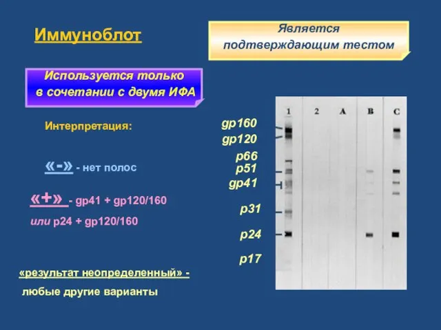 Иммуноблот gp160 gp120 p51 gp41 p31 p24 Интерпретация: «-» - нет полос