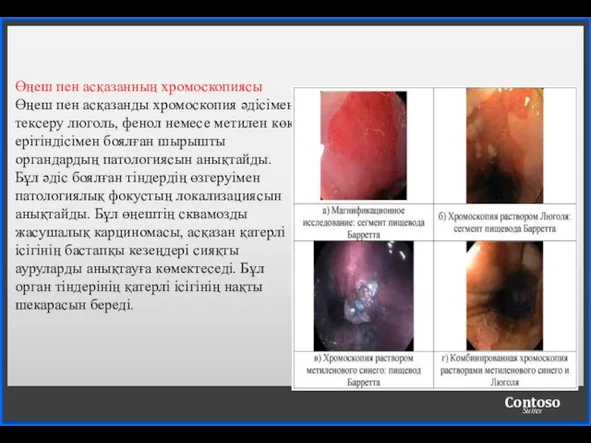 Өңеш пен асқазанның хромоскопиясы Өңеш пен асқазанды хромоскопия әдісімен тексеру люголь, фенол