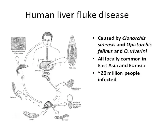 Human liver fluke disease Caused by Clonorchis sinensis and Opistorchis felinus and