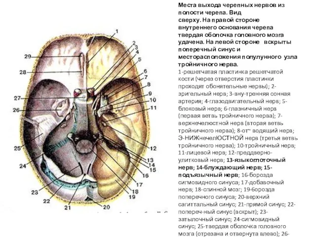 Места выхода черепных нервов из полости черепа. Вид сверху. На правой стороне