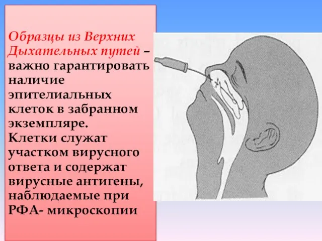 Образцы из Верхних Дыхательных путей – важно гарантировать наличие эпителиальных клеток в