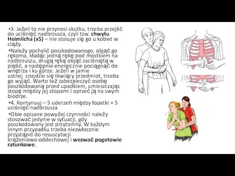 3. Jeżeli to nie przynosi skutku, trzeba przejść do uciśnięć nadbrzusza, czyli