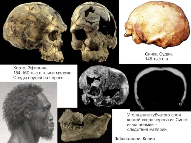 Херто, Эфиопия, 154-160 тыс.л.н. или моложе Следы орудий на черепе Синга, Судан,